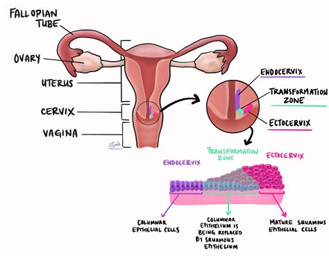 Atypical Squamous Cells Cervix