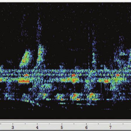 (PDF) Soundscape Ecology: The Science of Sound in the Landscape