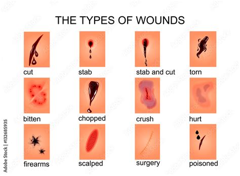 the types of wounds Stock Vector | Adobe Stock