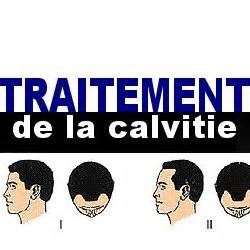 Traitement de la calvitie / www.traitement-calvitie.com