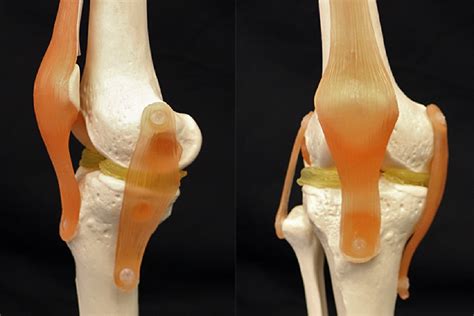 3D printing could help repair damaged knees with cartilage-mimicking ...