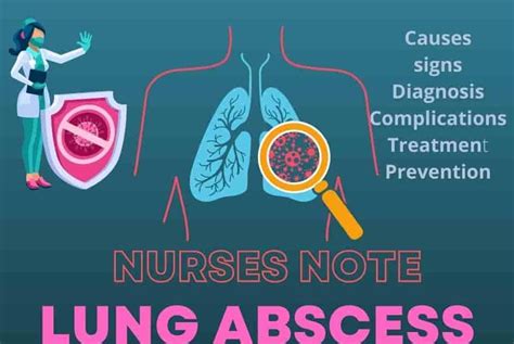 Lung Abscess: Causes, Signs, Diagnosis, Complications, Treatment ...