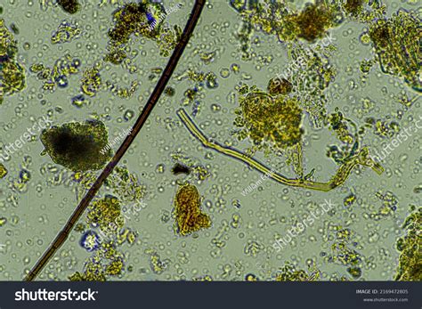 Fungal Fungi Hyphae Under Microscope Soil Stock Photo 2169472805 ...