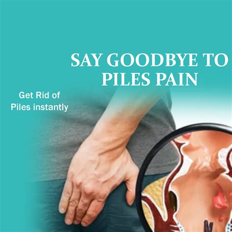 WHAT IS THE BEST TREATMENT FOR PILES Low-grade piles can be