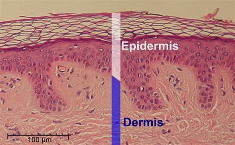 Epidermis - Wikipedia