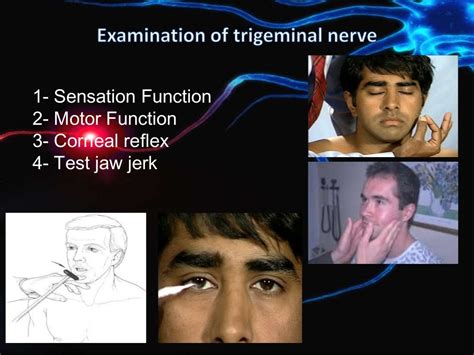 Trigeminal nerve examination