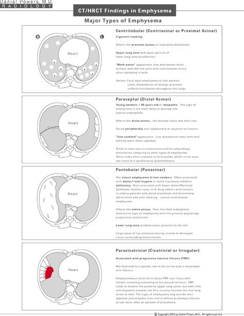 Emphysema Diagrams