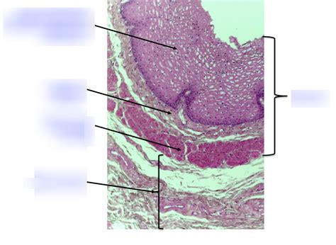 esophagus Diagram | Quizlet