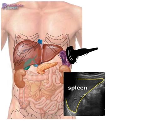 Abdominal ultrasound