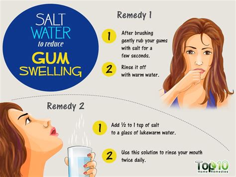 Home Remedies to Reduce Gum Swelling | Top 10 Home Remedies