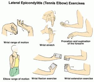 Lateral Epicondylitis Exercises