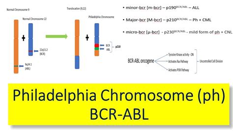 Philadelphia Chromosome [Ph] – Introduction, variants of BCR ABL gene ...