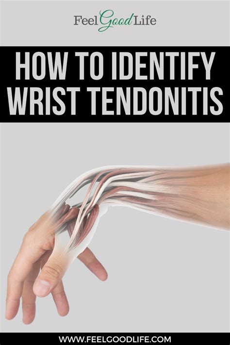 Best exercises for wrist tendonitis to help your pain diminish – Artofit