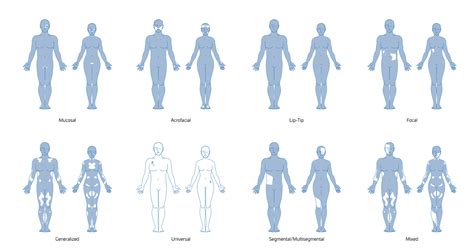 Vitiligo Chart