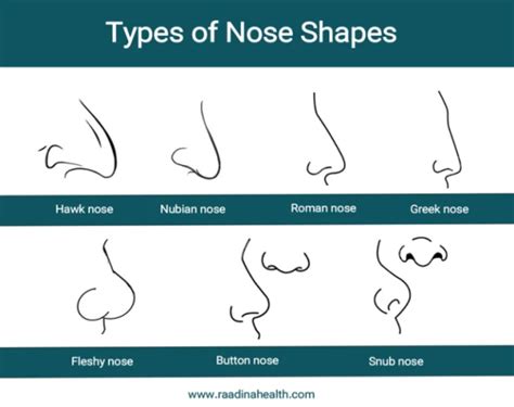 Different Nose Types