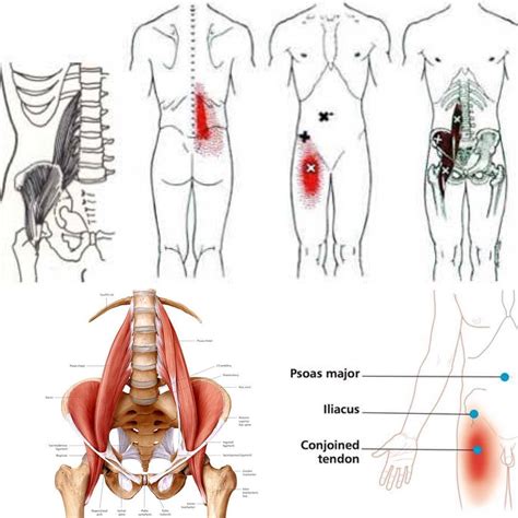 The psoas major... - Release Physical Therapy Washington DC