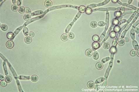 Candida albicans - Doctor Fungus