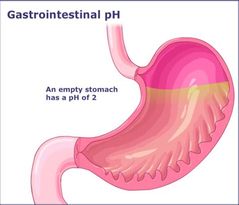 Gastric Acid Ph