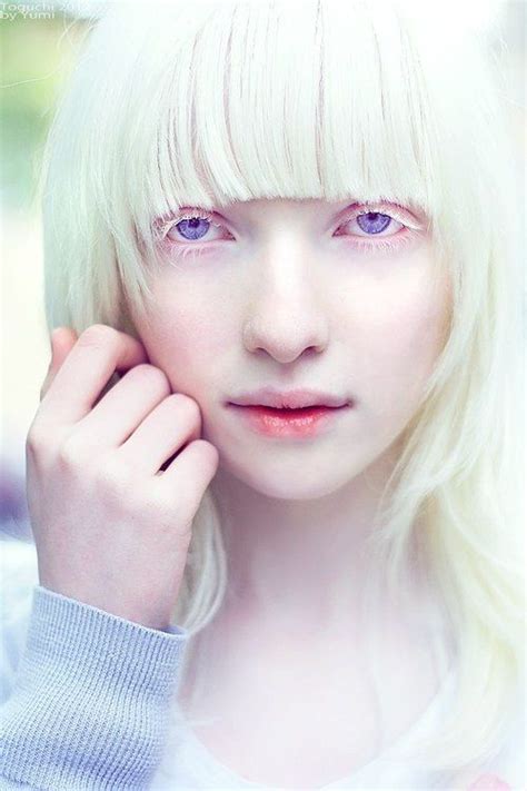 Nastya Zhidkova -- Albino - Beauty - Portrait - Photography Pink Eyes ...