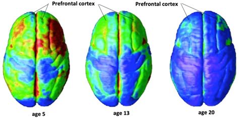 Development of the cortex' functions: The PFC | Download Scientific Diagram