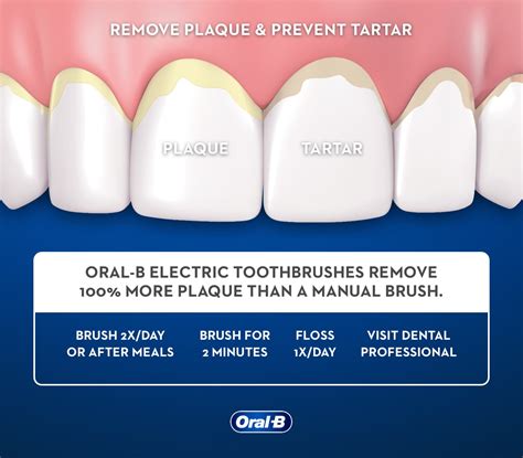 How to Get Rid of Plaque and Remove Tartar Buildup - Oral-B