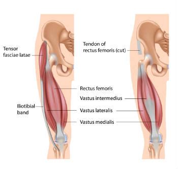 Tight Rectus Femoris Tips - Low Back Pain Program