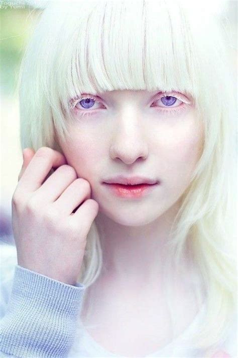 Pin on Albino Beauty.