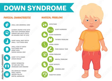 Symptoms of down syndrome vector infographic poster Stock Vector ...