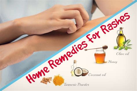 Skin Rash Home Remedies