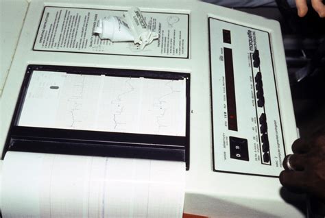 2 Electrocardiogram machine Images: PICRYL - Public Domain Media Search ...