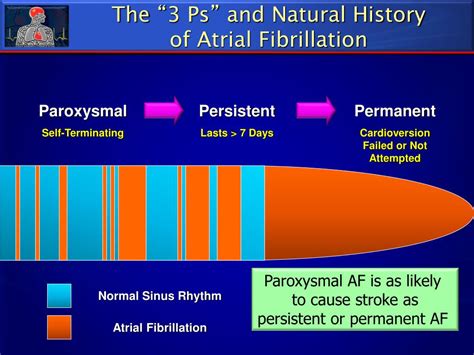 PPT - Stroke Prevention in Atrial Fibrillation PowerPoint Presentation ...