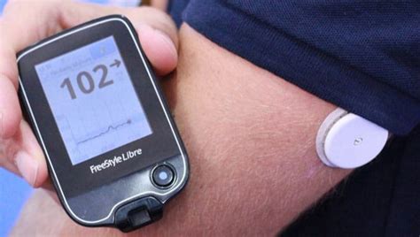 Wearable Blood Sugar Monitor - Awesome Stuff 365