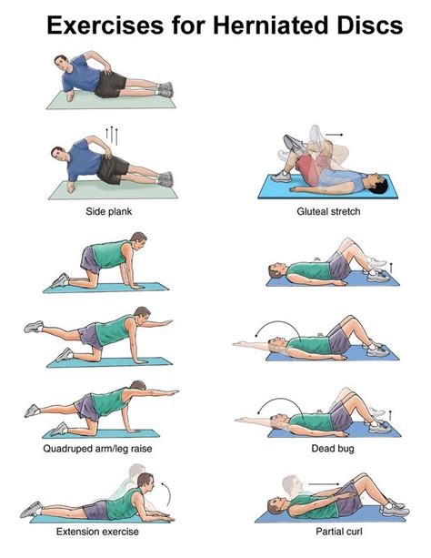 Herniated Disc Exercises