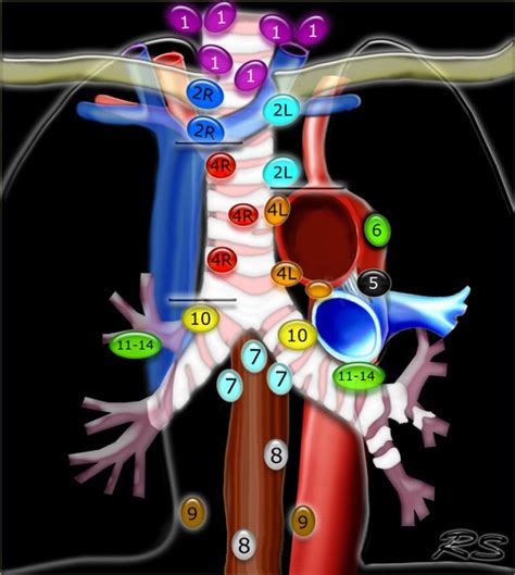 The Radiology Assistant : Mediastinal Lymph Node Map (2023)