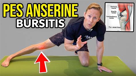 Pes Anserine Bursitis Exercises Google Search Bursitis Knee Knee | The ...