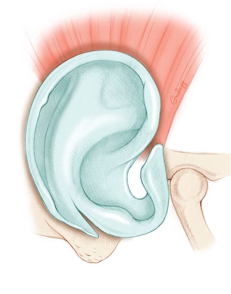 External Ear – Oto Surgery Atlas