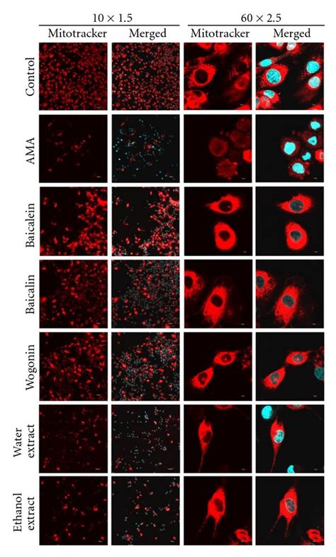 Confocal microscopy of mitochondria. Distribution of Mitotracker red ...