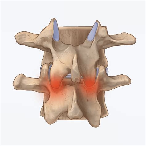 What is the facet joint? - Backspace