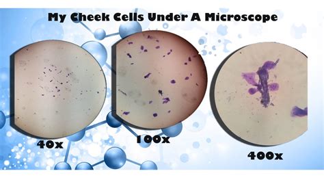 Cheek Cells Lab – Nicholas's Blog