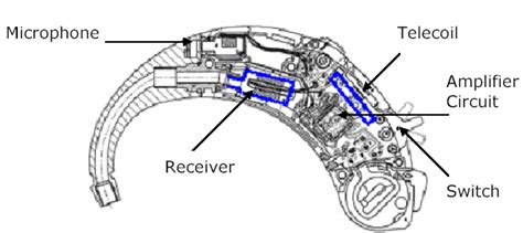 Assembly diagram of BTE Hearing Aid | Download Scientific Diagram