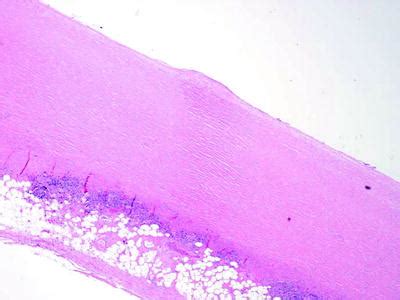 Pleura Histology