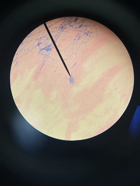 nervous tissue Diagram | Quizlet