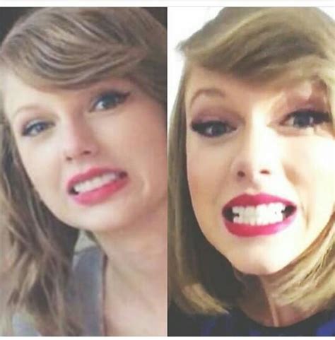 Taylor Swift Teeth Before And After Veneers