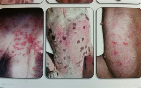 Flea Allergy Dermatitis On Humans