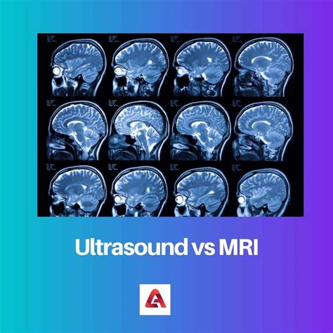 Ultrasound vs MRI: Difference and Comparison