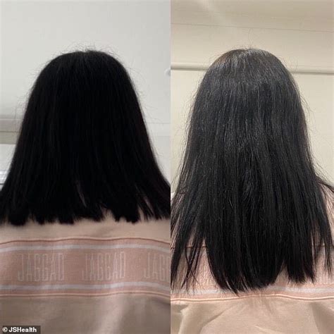 38+ hair growth before and after 6 months - OgdenAlia