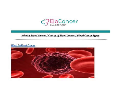 What is Blood Cancer | Causes of Blood Cancer | Blood Cancer Types by ...