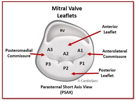 Mitral Valve Anatomy: Name 5 Components! Cardioserv