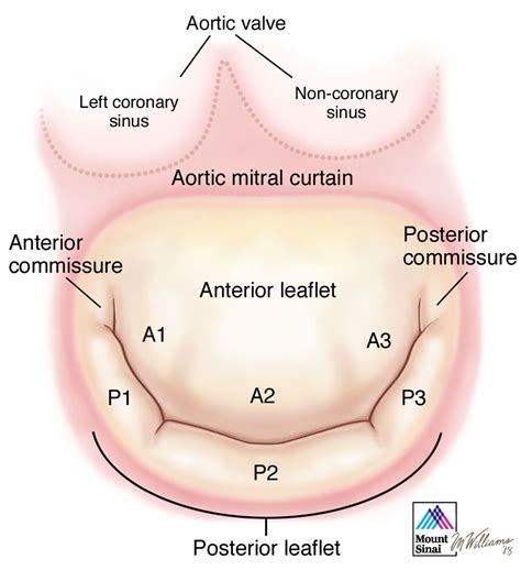 Leaflets | Mitral Valve Repair Center