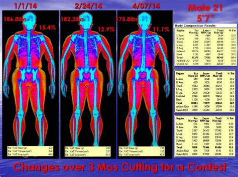 DXA Body Composition & Visceral Fat Testing San Antonio, The Most ...